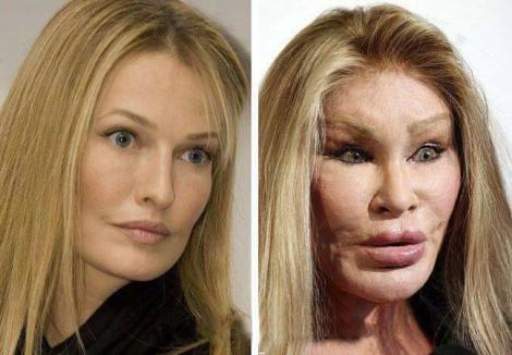 Înainte „ca de liceu”, după adevărate exponate de „muzeu”! Nicole Kidman, Donatella Versace, Pamela Anderson, desfigurate! GALERIE FOTO