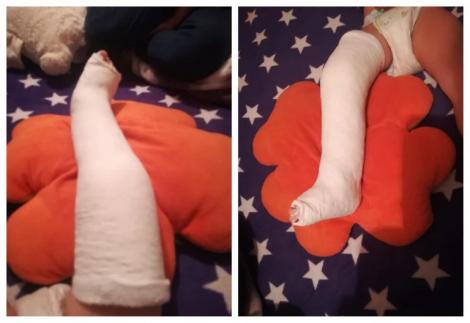 Copil cu piciorul rupt, trimis acasă să ia pastile pentru durere! Mama, acuzații grave: ”Au spus că e contuzie, deși era fractură!”