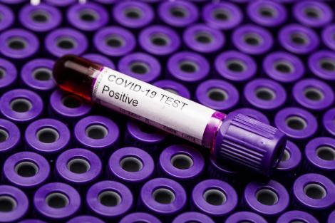 Coronavirus România 30 iunie 2020. Live Update. O nouă explozie a numărului de infectări! Aproape 400 de cazuri noi de COVID-19, descoperite în ultimele 24 de ore