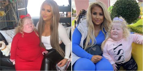 Cazul real al fetiței care cântărește aproape 45 de kilograme la doar 5 ani: „Mănâncă tot, apoi îi este din nou foame”